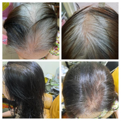 Combo 2 Dầu gội nhuộm tóc thảo dược Lich5 - Lên màu tự nhiên - Sử dụng đơn giản, tiện lợi, mùi dễ chịu