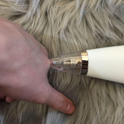 Máy Hút Mụn Đầu Đen, Mụn Cám Cực Mạnh Cầm Tay Black Head Detector (Trắng) Sữa rửa mặt dành cho da mụn