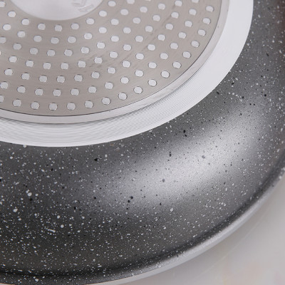 Chảo nhôm chống dính đáy từ Kangaroo KG654 (20cm, 22cm, 26cm, 28cm) - Hàng chính hãng