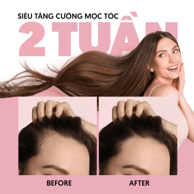 Dầu gội MILAGANICS - Keratin & Biotin, mọc tóc nhanh, ngừa rụng, hiệu quả sau 2 tuần - 240ml