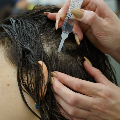 Huyết Thanh Chăm Dưỡng Tóc Bị Rụng, Dưỡng tóc - 10ML x 10 ỐNG