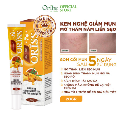 Kem Nghệ Giảm Mụn Oriss Giúp Mờ Thâm Sẹo Dưỡng Ẩm Sáng Da 20g