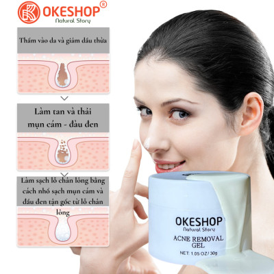 Gel Lột Mụn Nha Đam OKESHOP 30ml - Giải Pháp Loại Bỏ Mụn Đầu Đen - Mụn Cám - Bạ Nhờn - Làm Sạch Sâu Và Thu Nhỏ Lỗ Chân Lông