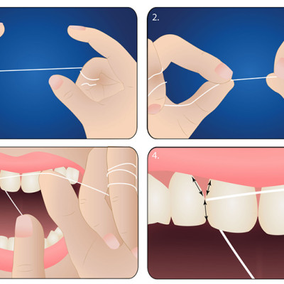 Chỉ nha khoa hương Lô hội và Bạc hà Pierrot 30m - loại mở rộng