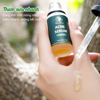 Acne serum, serum mụn thảo mộc đánh bay mọi loại mụn cứng đầu Wonmom 20ml