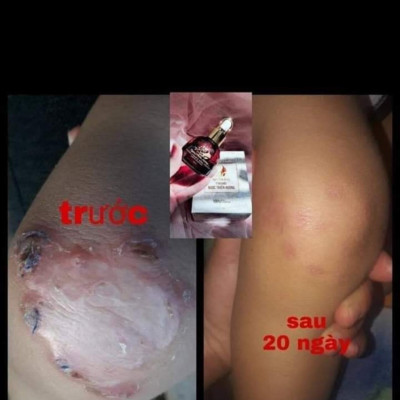 Tinh chất Ngọc Thiên Hương