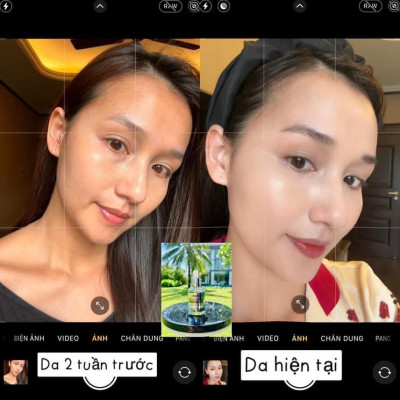 Tinh chất serum peel da moose+ 30ml Hàn Quốc, tái tạo da, phục hồi da