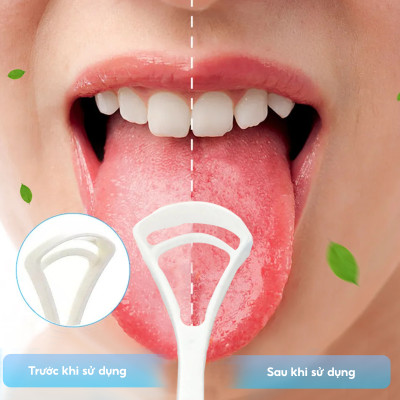 Dụng cụ cạo lưỡi Coral, bộ 2 cái siêu tiết kiệm. Thiết kế 2 mặt cho 2 nhu cầu vệ sinh