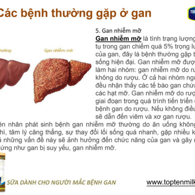Sữa dinh dưỡng cho gan,mát gan giải độc, liver gold 400g topten milk