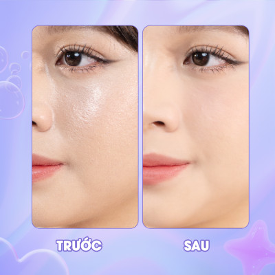 Kem Che Khuyết Điểm myKella Che Phủ Hoàn Hảo, Phù Hợp Với Mọi Loại Da - Magic Creamy Concealer 5ml