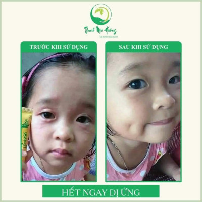 Kem bôi da thuần mộc kem bôi nấm ngứa Thanh Mộc Hương 16gr